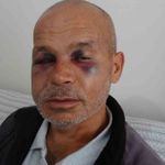 Adana Kozan'da engelli vatandaş neden darbedildi