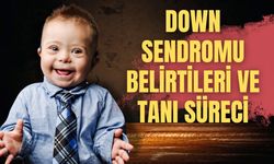 Down Sendromu Belirtileri ve Tanı Süreci