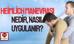 Heimlich Manevrası Nedir, Nasıl Uygulanır? Hayat Kurtaran İlk Yardım Tekniği