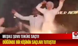 Düğün Eğlencesi Kâbusa Döndü! Meşale Şovunda Saçlar Alev Aldı!