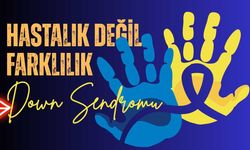 Down sendromlu bireyler için umut dolu bir gelecek mümkün
