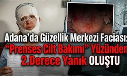 Adana'da Güzellik Merkezi Faciası: "Prenses Cilt Bakımı" Yüzünden 2. Derece Yanık Oluştu