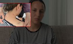 17 Bıçak Darbesi Alan Genç Kadın 'Ölü Numarası' Yaparak Kurtuldu!