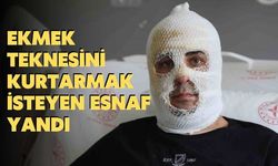 Ekmek Teknesini Kurtarmak İsteyen Esnaf Yandı