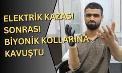 Elektrik kazası sonrası biyonik kollarına kavuştu