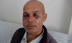 Adana Kozan'da engelli vatandaş neden darbedildi