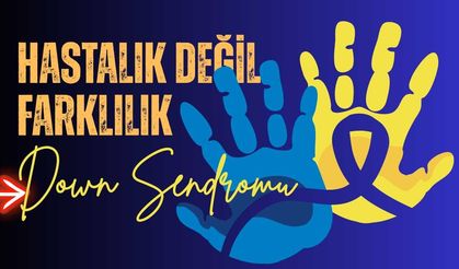Down sendromlu bireyler için umut dolu bir gelecek mümkün