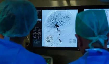 “İki İlde Tespit Edildi! Deli Dana Hastalığı Türkiye’de!”