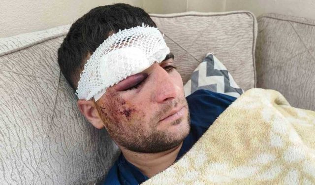 Döner ustası motosiklet sürücüsü: “Kaza sonrası kaçıp gittiler”