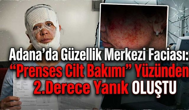 Adana'da Güzellik Merkezi Faciası: "Prenses Cilt Bakımı" Yüzünden 2. Derece Yanık Oluştu