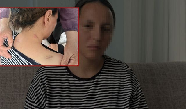 17 Bıçak Darbesi Alan Genç Kadın 'Ölü Numarası' Yaparak Kurtuldu!