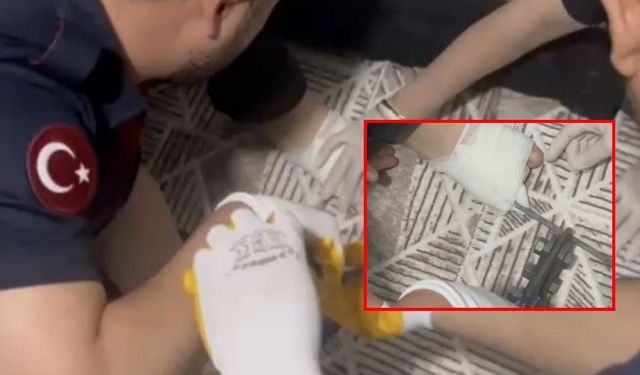 Osmaniye'de Korkutan Olay: Küçük Çocuğun Ayağına Mangal Şişi Saplandı