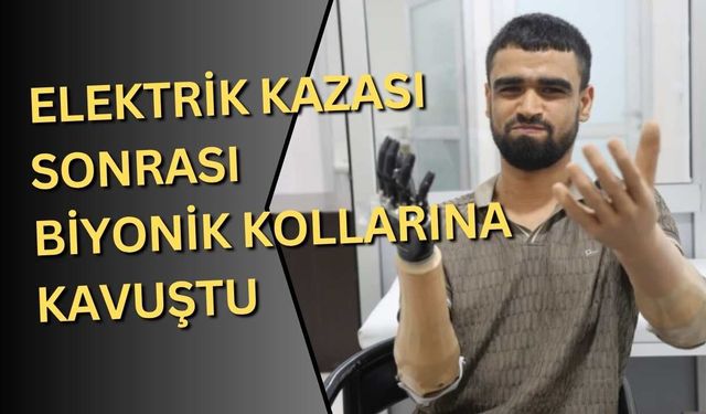 Elektrik kazası sonrası biyonik kollarına kavuştu