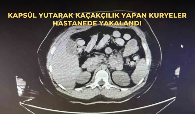 Kapsül yutarak kaçakçılık yapan kuryeler hastanede yakalandı
