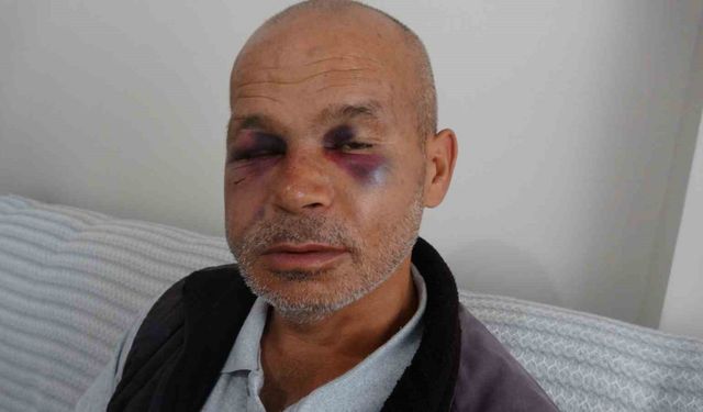 Adana Kozan'da engelli vatandaş neden darbedildi