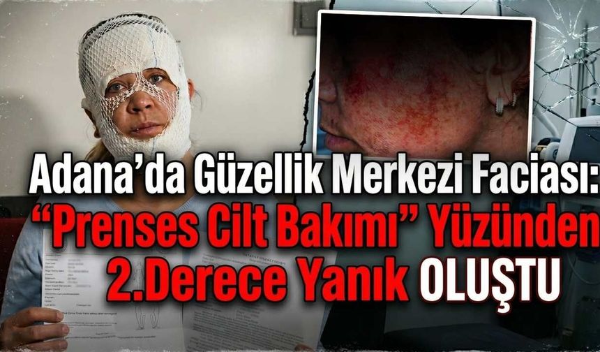 Adana'da Güzellik Merkezi Faciası: "Prenses Cilt Bakımı" Yüzünden 2. Derece Yanık Oluştu