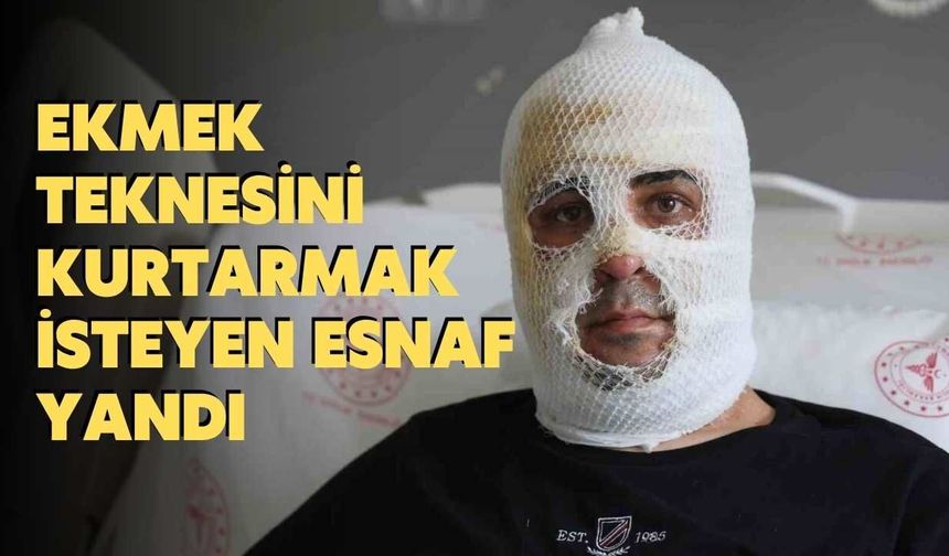 Ekmek Teknesini Kurtarmak İsteyen Esnaf Yandı