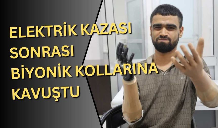 Elektrik kazası sonrası biyonik kollarına kavuştu