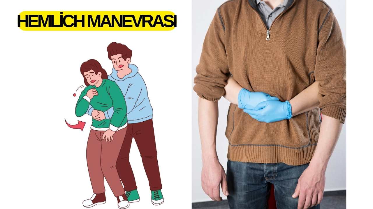 Hemlich Manevrası Osmaniye 112 Telefonla Hayat Kurtardı (3)