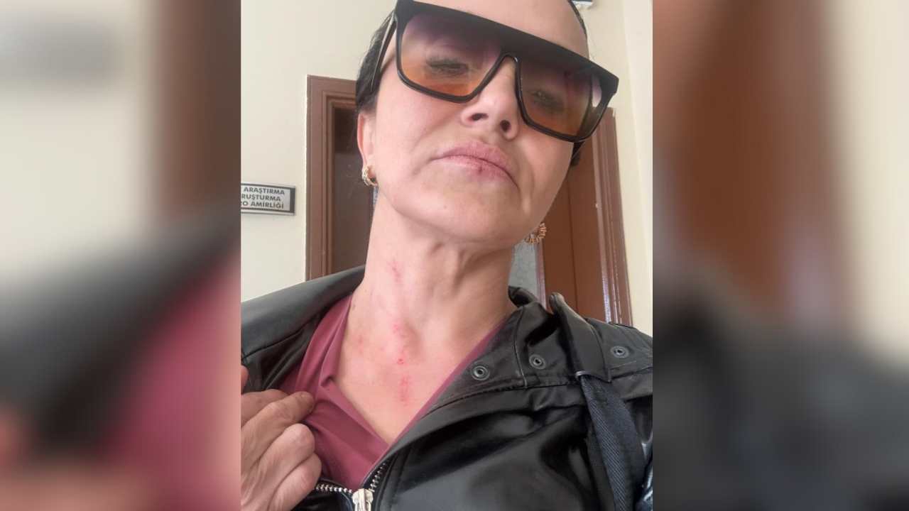 Boşanmak Istedi, Hayatı Kabusa Döndü “Evime Bile Giremiyorum” (2)