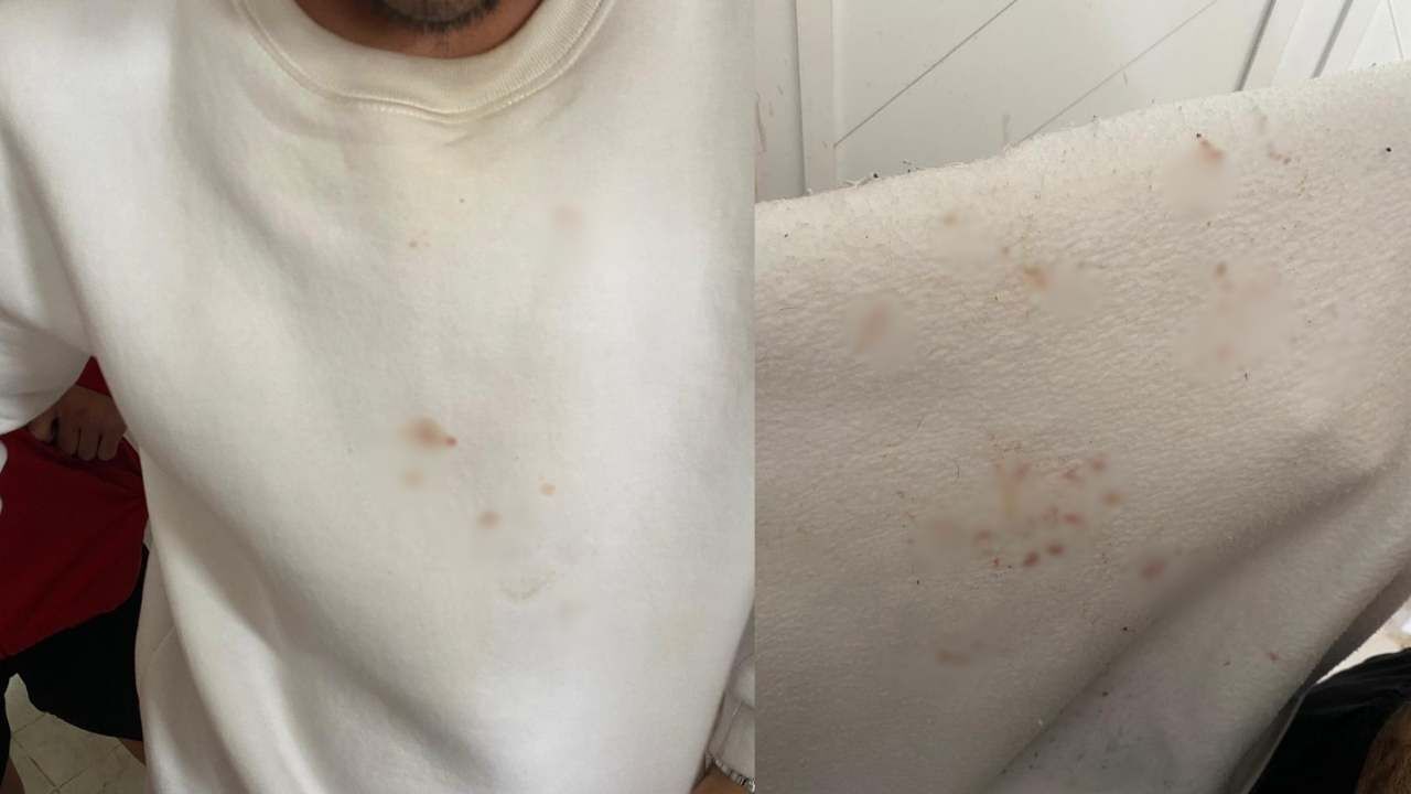 Osmaniye Temsilcisi Bahçespor’a Anamur’da Alçak Saldırı! Teknik Direktör'ün Kaburgasını Kırıp Futbolculara Saldırdılar! (4)