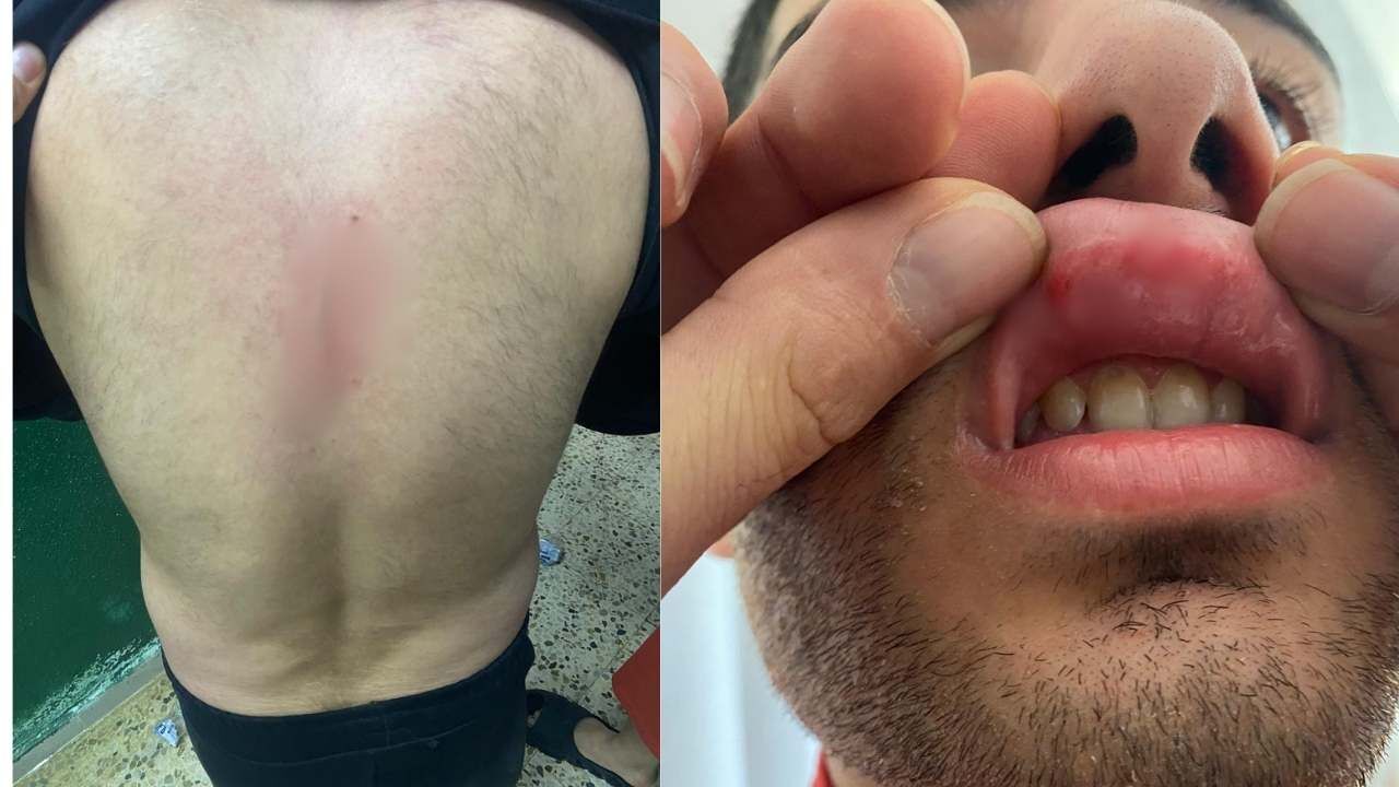 Osmaniye Temsilcisi Bahçespor’a Anamur’da Alçak Saldırı! Teknik Direktör'ün Kaburgasını Kırıp Futbolculara Saldırdılar! (5)