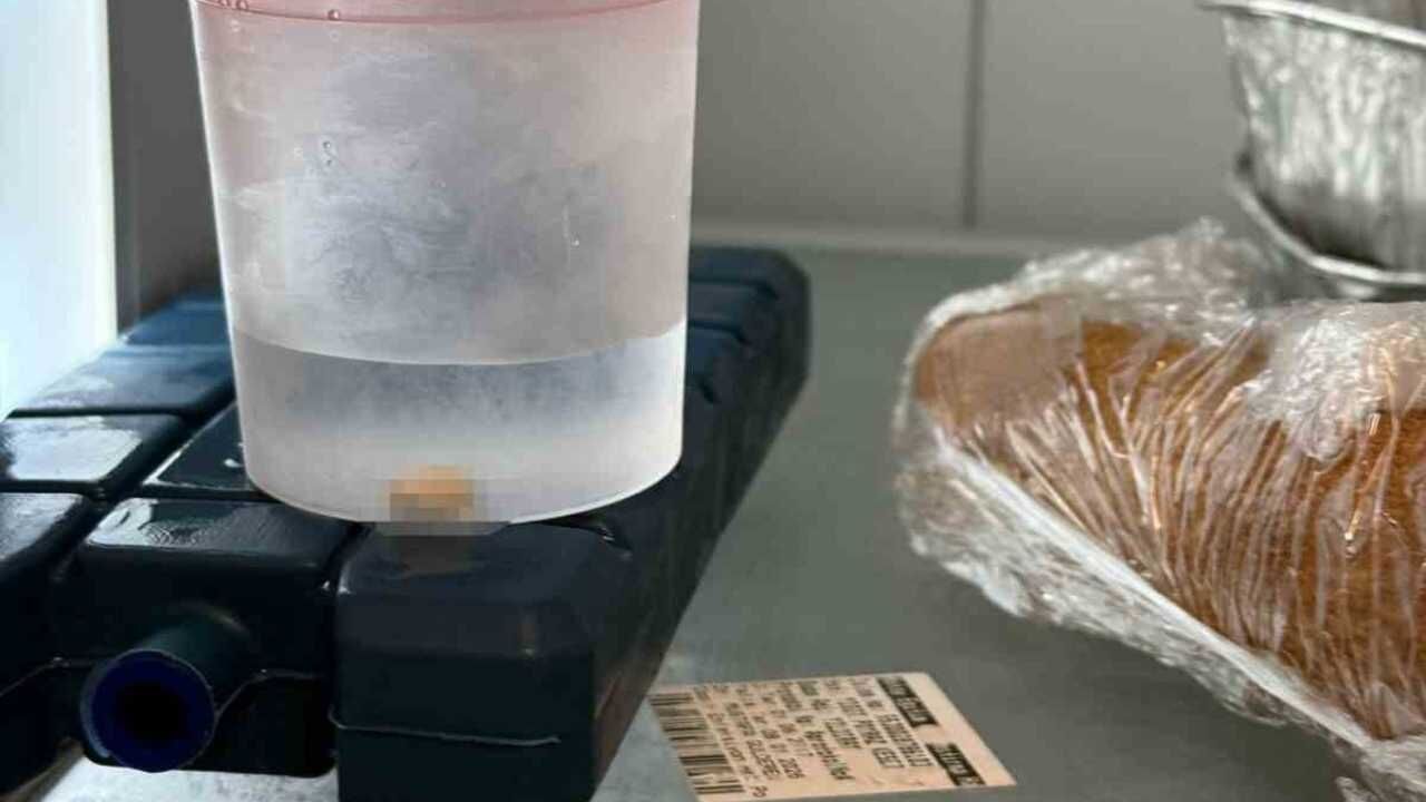 Serum Çıkarılırken 5 Aylık Bebeğin Parmağı Kesildi (2)