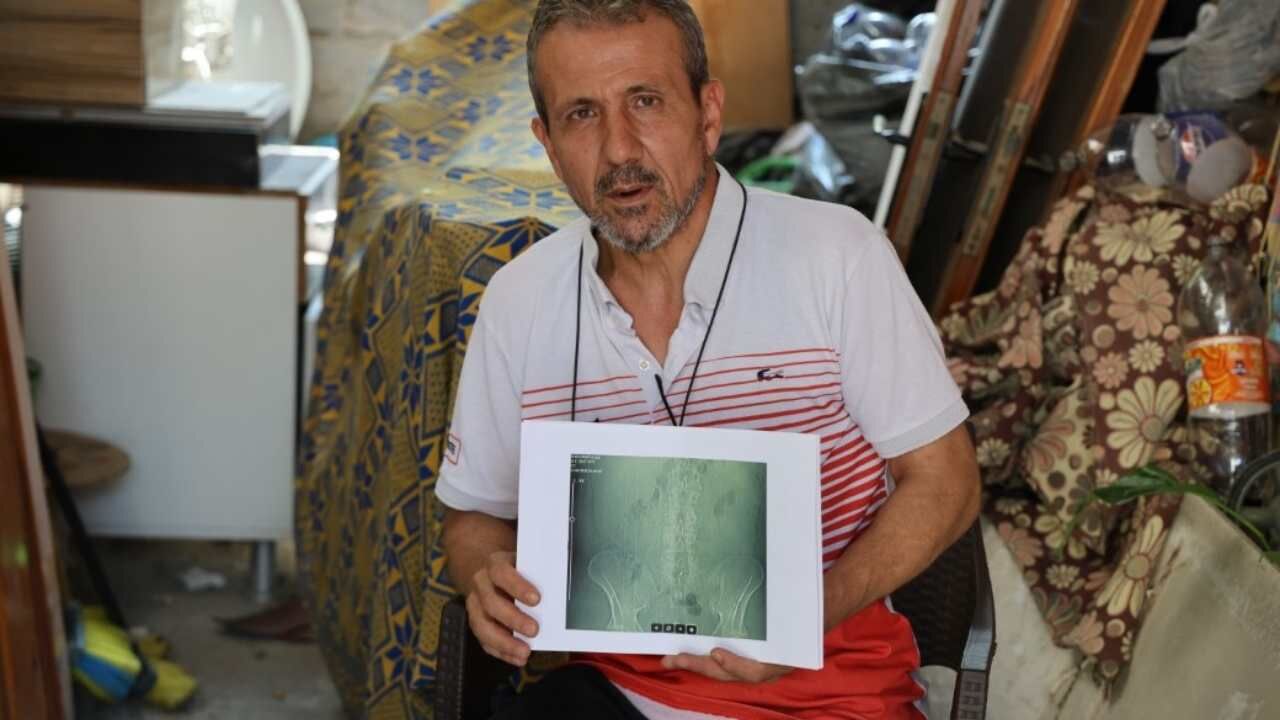Belinde Panç Unutulan Hasta Neden Ameliyat Edilemiyor (2)